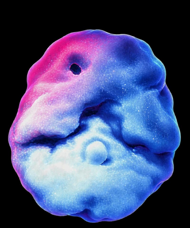 Scansione SPECT di un cervello a riposo, vista dall'alto: il flusso sanguigno è uniforme e non ci sono zone scure.